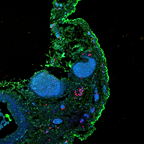 BCF295 Laser Scanning Confocal Microscopy