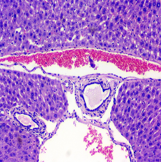 BLM2-241 LCD Digital Biological Microscope