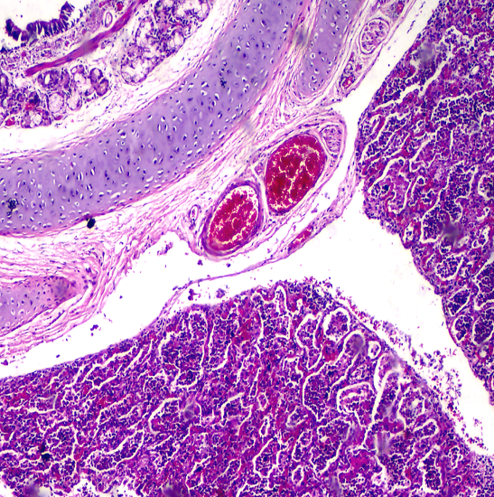 BLM2-241 LCD Digital Biological Microscope