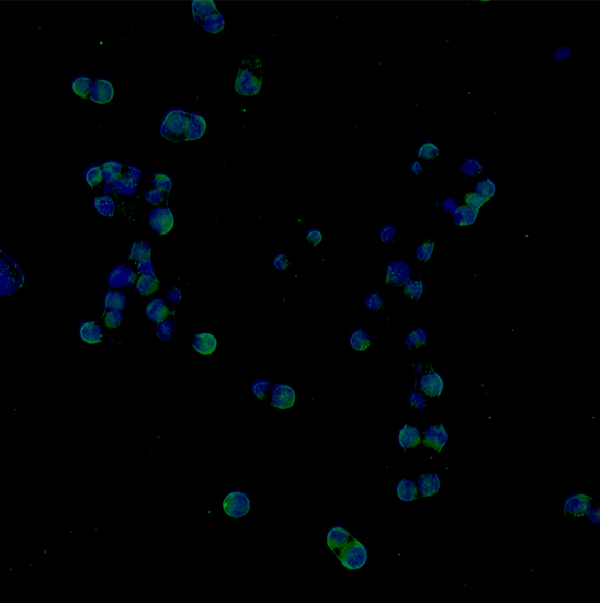 BS-2085F Motorized Automatic Biological Fluorescent Microscope