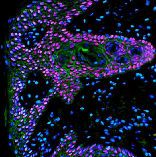 BS-2085F Motorized Automatic Biological Fluorescent Microscope