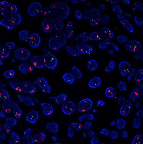 BS-2085F Motorized Automatic Biological Fluorescent Microscope