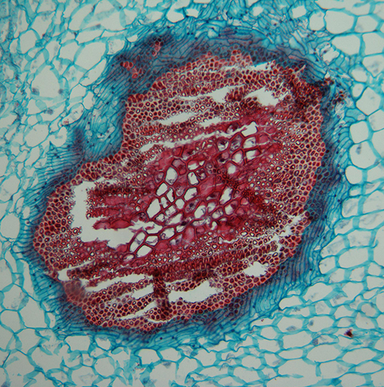 BLM-205 LCD Digital Biological Microscope