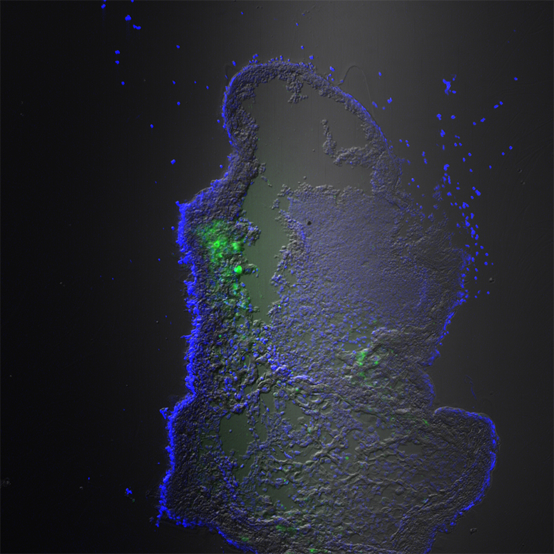 BCF297 Laser Scanning Confocal Microscopy