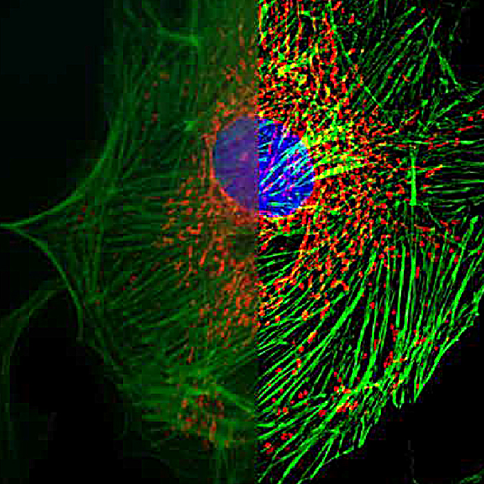 B-SIM298 Structured Illumination Fluorescence Microscope