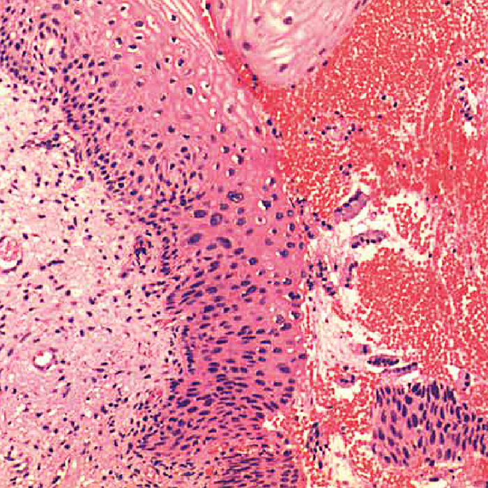 BS-2098 Research Inverted Microscope