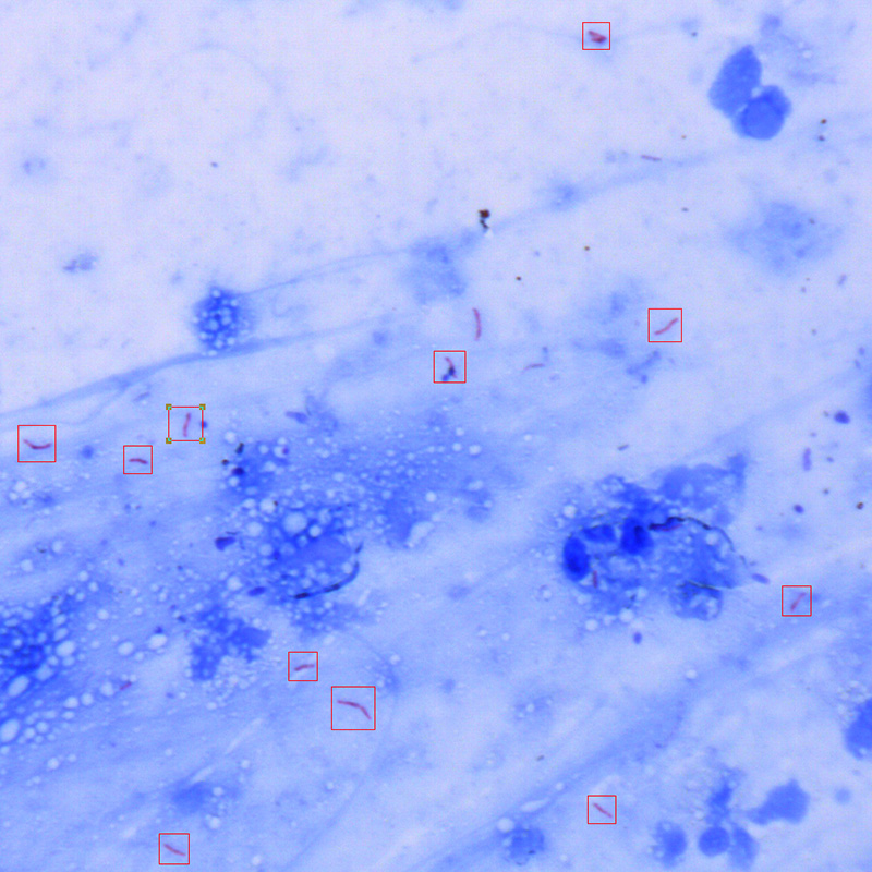 Scanpro 3-50FL Fluorescence Mycobacterium Tuberculosis Microscopy Scanning System